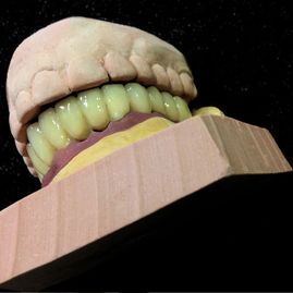 Prótesis Dental Dentic molde y prótesis