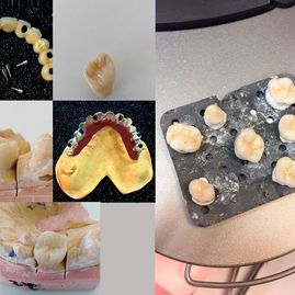 Prótesis Dental Dentic prótesis dentales