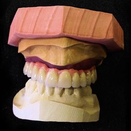 Prótesis Dental Dentic dentadura