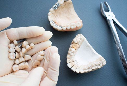 Prótesis Dental Dentic persona haciendo prótesis